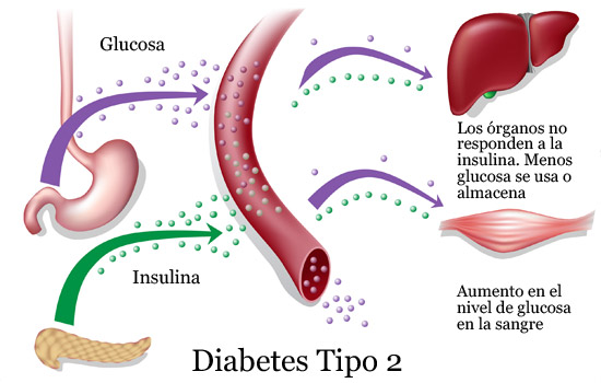 Asociación Mejicana de Diabetes