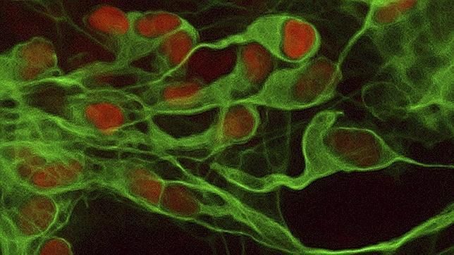 Defecto neuronal